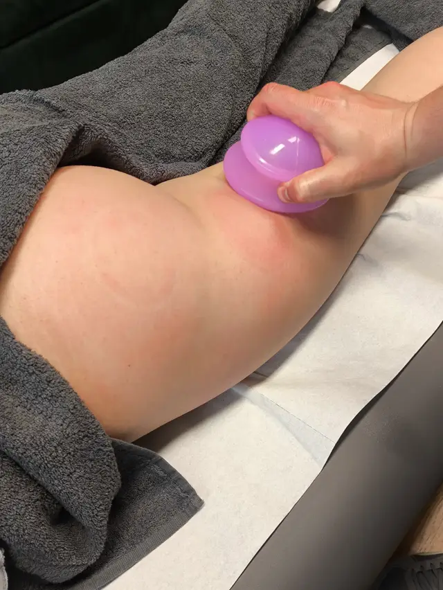 Masaż antycellulitowy bańką, praca na udzie i pośladku